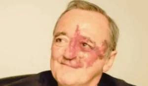 mariano barbacid tumore pancreas