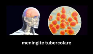meningite tubercolare