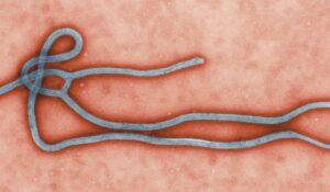 Ebola