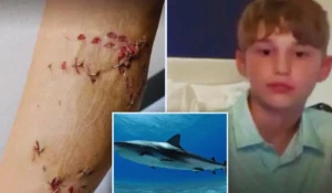 Bambino di 12 anni attaccato da squalo durante vacanza