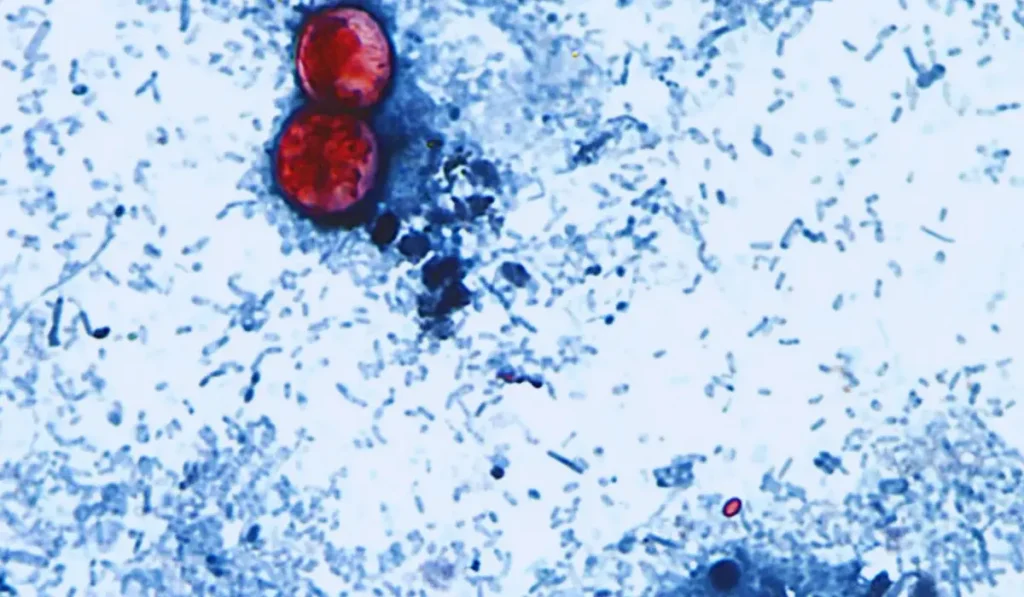 Cyclospora parassita intestinale sotto il microscopio